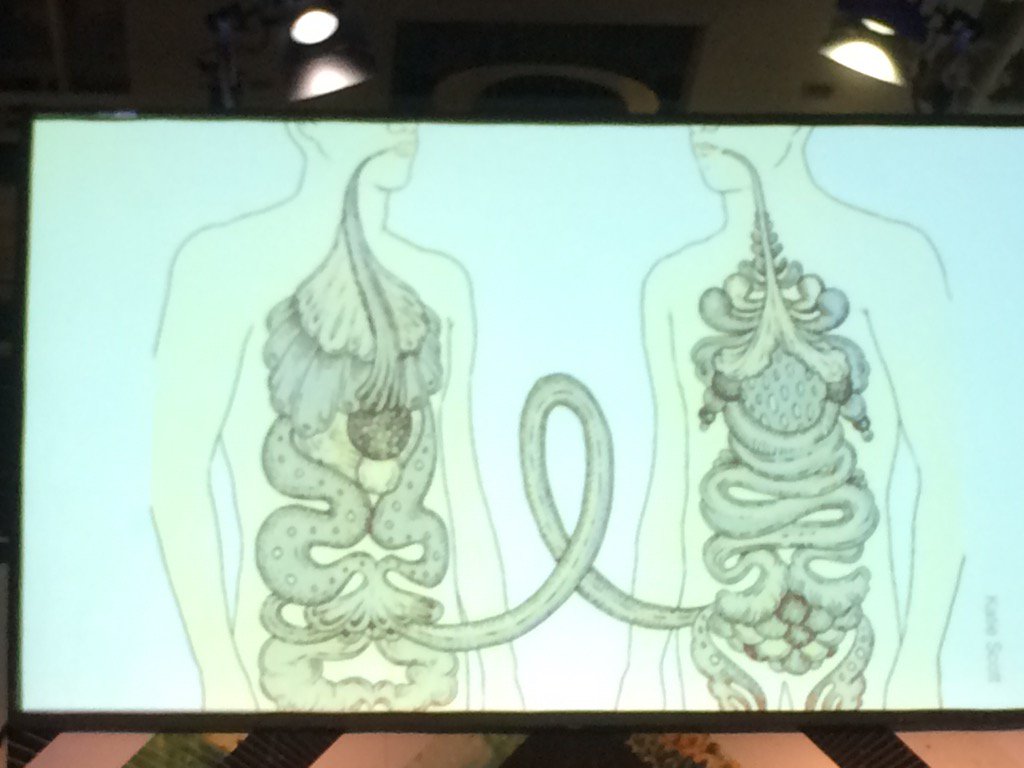 meganwmoyer's tweet photo. Poop transplants: apparently gut microbes are a key factor in #hackinghumanbody @davidsunkong @dg717sf https://t.co/olK2b5H6vX