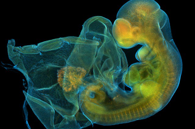 sebuvijejazapi's tweet photo. Miniature Spinal Cords Grown In The Lab
https://t.co/BpVLuI1Kmr https://t.co/YEFr8FF8OL