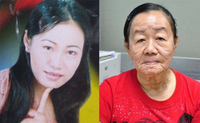 hondax038's tweet photo. 【ベトナム】老化病の女性が30歳で死亡、11年に日本メディアで話題[08/21]  
https://t.co/XB8DXSq5sN https://t.co/5aLPu0j3bK