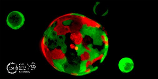 CSHL's tweet photo. Joining forces to learn why GI & #pancreaticcancer affect Afr Americans much more https://t.co/rQV7sNvJTd #GoLIsci https://t.co/hTx3GgOuZC