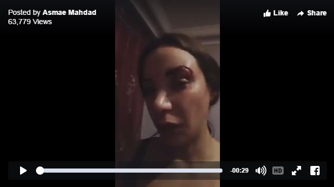 anissakaci's tweet photo. Loubna Abidar, l'actrice de "Much Loved", agressée au Maroc https://t.co/6OwkGmCJN6 https://t.co/rSMUXNAKbD