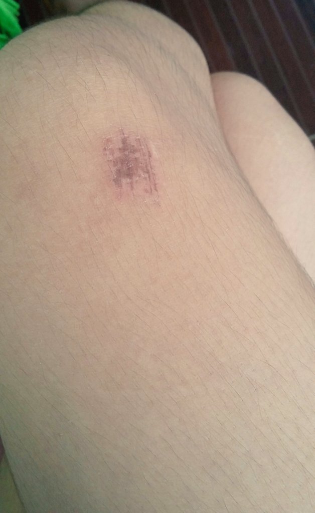 rEmz_06's tweet photo. Nasamad ang bata.Huhu π³ #volleyballproblem #volleyballpamore https://t.co/2NlZJxPo1D