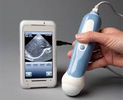 ShoulderImaging's tweet photo. Did you Know: There are now mobile apps and plugins that allow you take ultrasounds on your phone. #FunFactFriday https://t.co/O0TGuigMEG