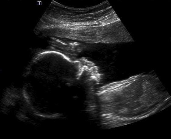 thirdandclover's tweet image. Exciting news! thirdandclover.com/2015/11/06/exc…