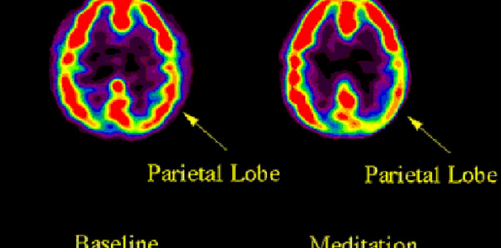 Meditation not only reduces stress, here’s how it changes your brain: ow.ly/UitCs