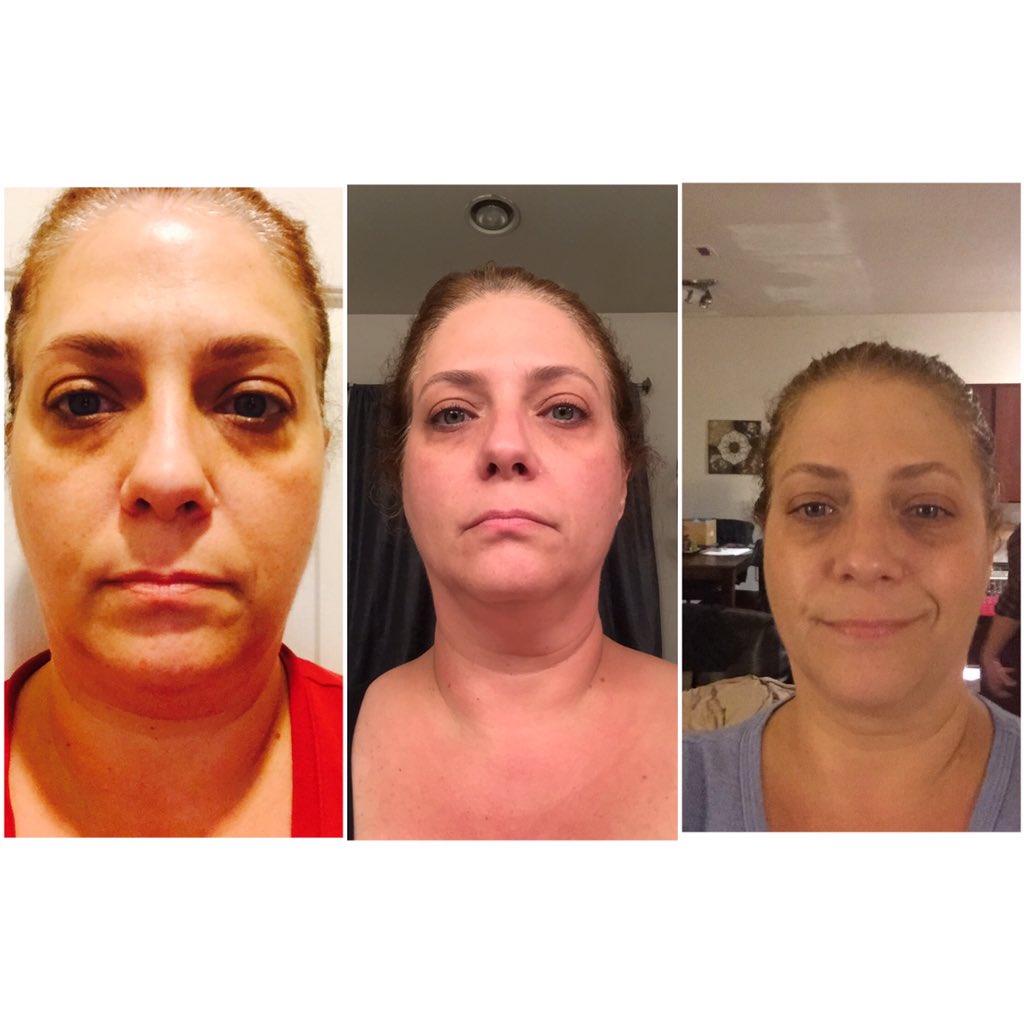 caseysdogcookie's tweet photo. #RFGoNaked https://t.co/GJe37WAPQ3