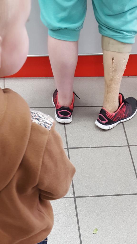 Heffie33's tweet photo. Worst false leg I've seen. #Amputation #Falseleg #FetchRex #jokes https://t.co/ka4zSbYcRT