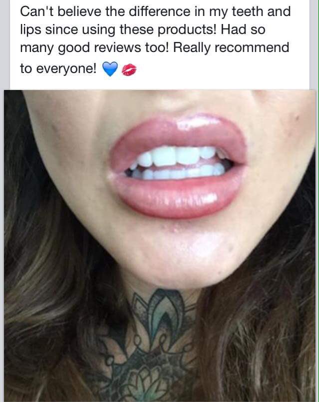 gemmaparker1966's tweet photo. Henhance your fish gape #fishgape #lipfiller #gloss #MustHave  #inlove https://t.co/YtHUnfVauW