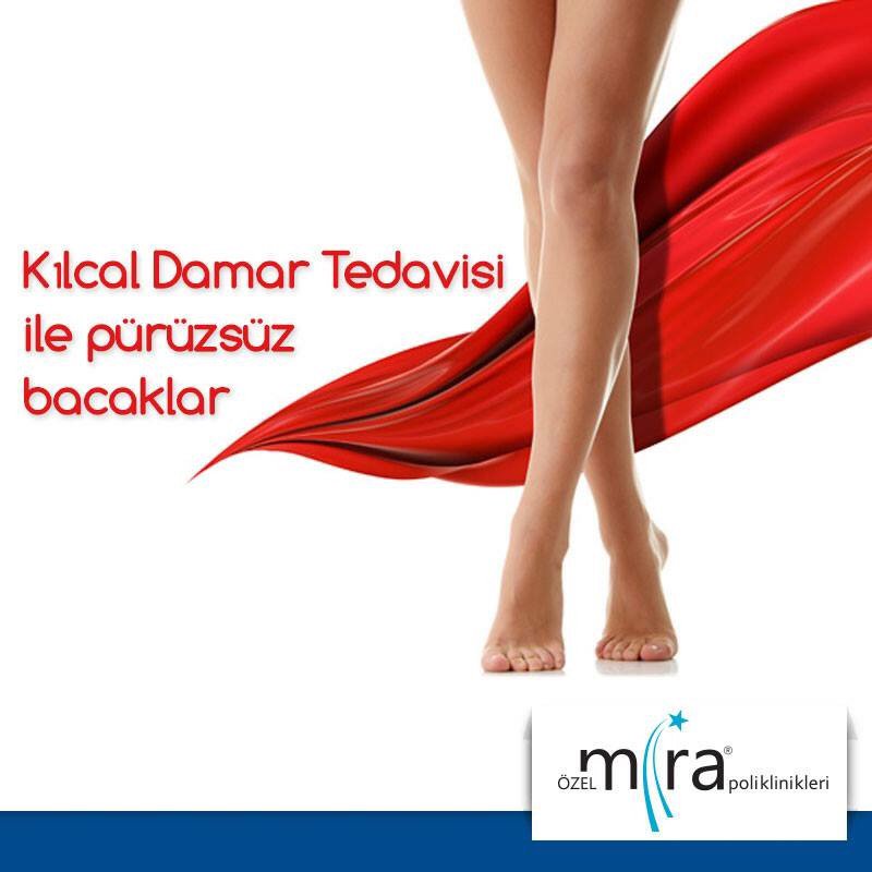 ozelmira's tweet photo. Kılcal damar varisleri çok ince damarlar olup, rahatsız eder. 

Kılcal damar tedavisi için geç kalmayın; 444 34 89 https://t.co/TzBFARic21
