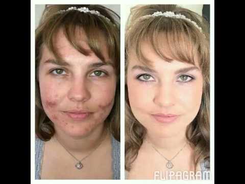 liddlee's tweet image. I love the foundation and the concealer theygo so well 5drops of foundation 3drops of concealer message me for info