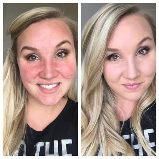 liddlee's tweet image. I love the foundation and the concealer theygo so well 5drops of foundation 3drops of concealer message me for info
