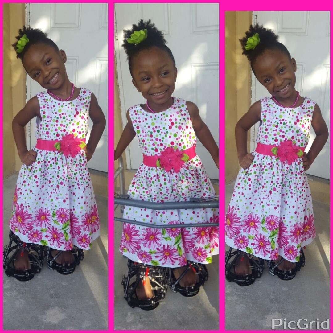 kclubfoot242's tweet photo. Kaylee on her way to church
#kayleeclubfootjourney #clubfoot #fixators #fighter #clubfoottoddler #dedication https://t.co/FxAAY2COiz