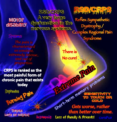 LuckyPenny_CRPS's tweet photo. Thank you all for your support #SaveChrisP60 https://t.co/89BZUfDjcW