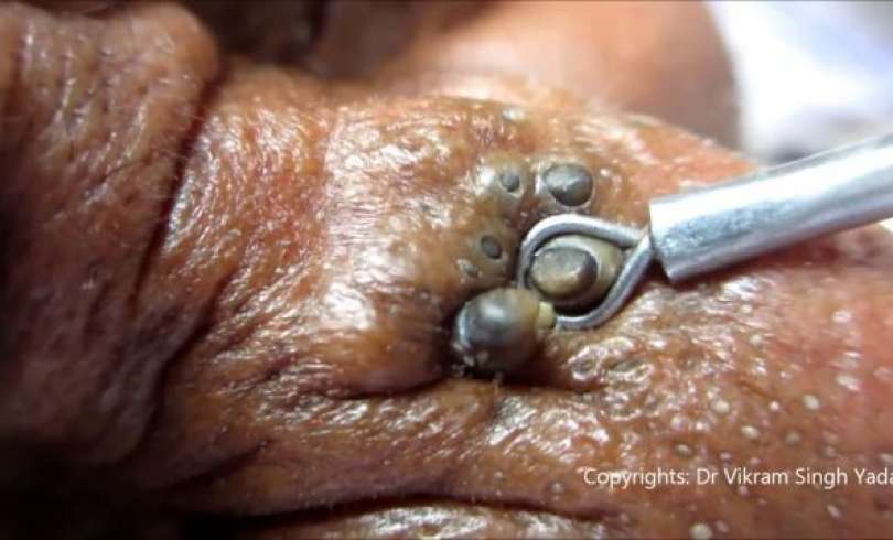 INCREIBLE VIDEO ! Encuentran punto negro de mas de 20 AÑOS
Ver video-->goo.gl/XW3Ew5