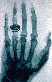 SiemensHealth's tweet photo. Röntgen produced the 1st X-ray image, a picture of his wife’s hand. Look at how far technology has come since then! https://t.co/Mv7GPXR9Jd
