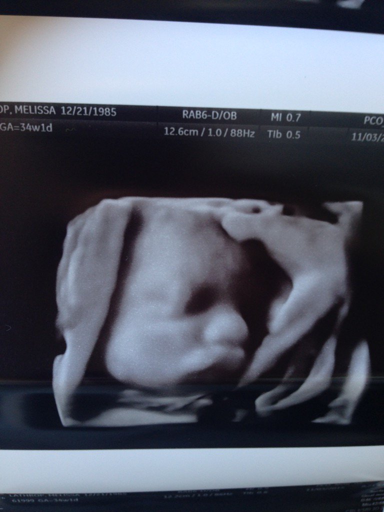 Melissa_Babiiii's tweet image. #35weeks #5left #DCGJR