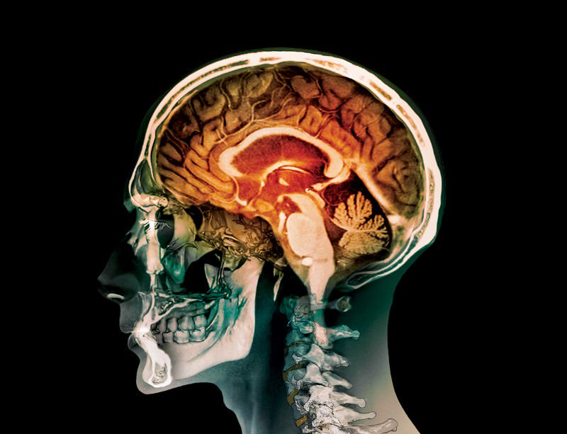 newscientist's tweet photo. The brain’s ultimate barrier has been opened for the first time. Our original story https://t.co/rc6u9ZMeQd https://t.co/ylmHXfq06v