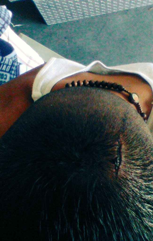 IsaiahRomero7's tweet photo. Nice split !! Trip to the ER it is!! https://t.co/rVOb5DBbh2