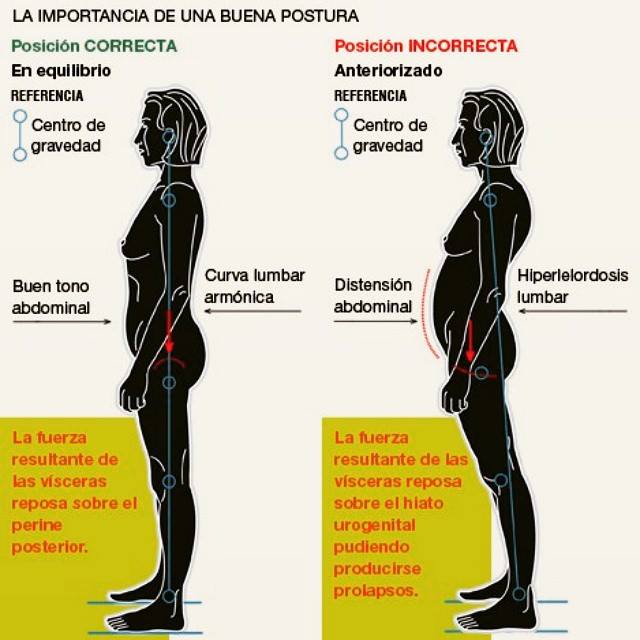 SRTArgentina's tweet photo. #Prevención
La importancia de una buena postura: ¿Cómo te parás? https://t.co/udoxytIYkS