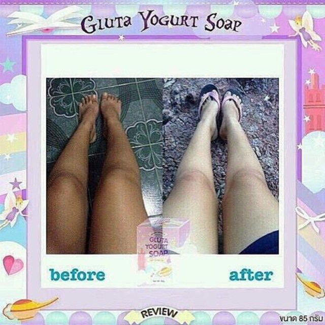 Saya menjual ... seharga Rp155.000. Dapatkan produk ini hanya di Shopee! shopee.co.id/clinicbeautysh… #ShopeeID