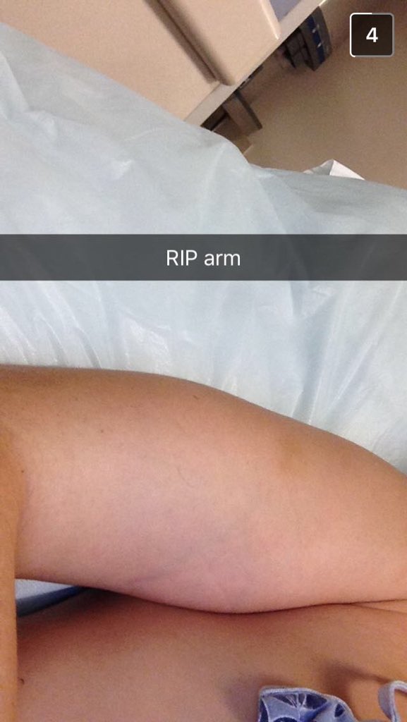 mattflaherty16's tweet photo. Cha boy broke his arm @colmocallaghan6 #frailbones https://t.co/DMZNJeiyFu