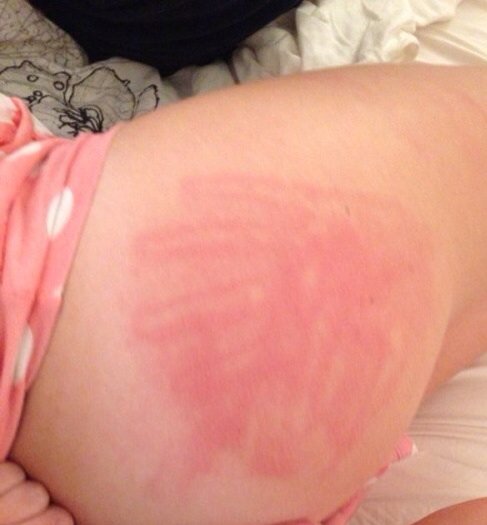 DannyMyrs's tweet photo. Spankings can end up red whoops sorry babe https://t.co/xUwDxSZWcA
