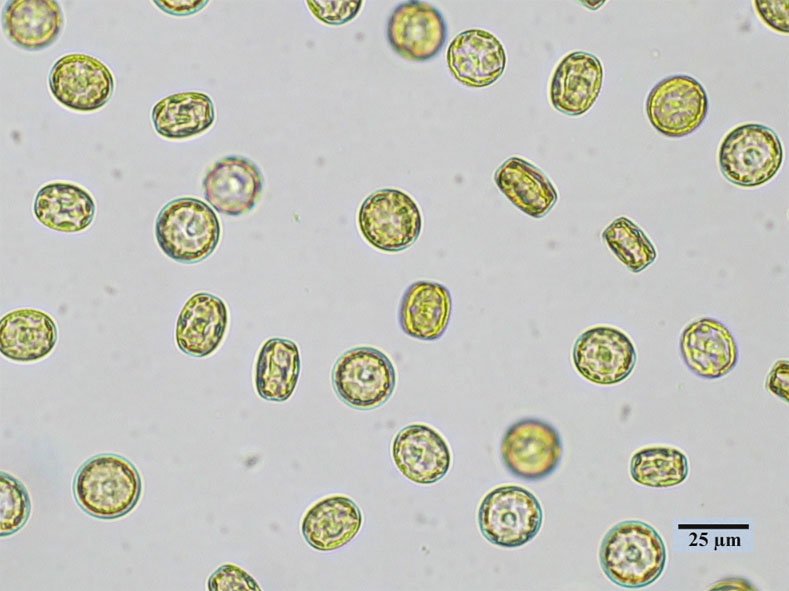 Phylum Chrysophyta (@pchrysophyta) / X