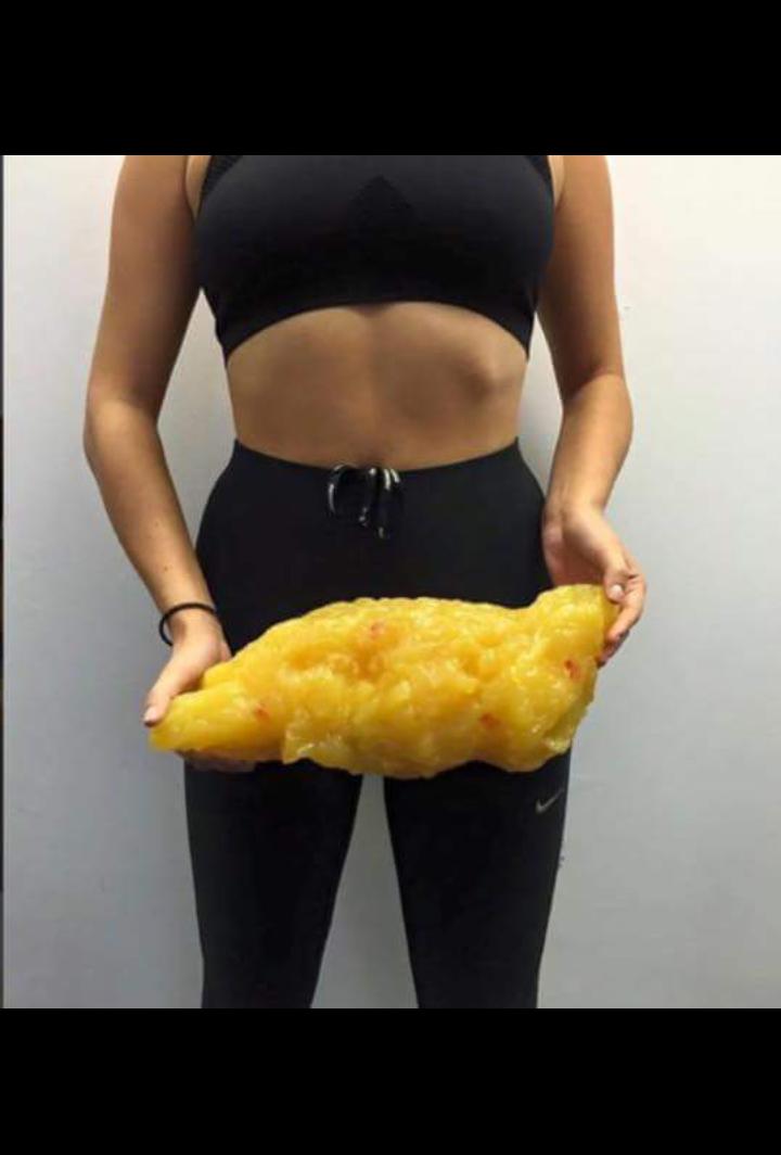 ryanevanspt's tweet photo. Never be Dissapointed you have lost 5lbs #fatisfat https://t.co/xRKkVODaju