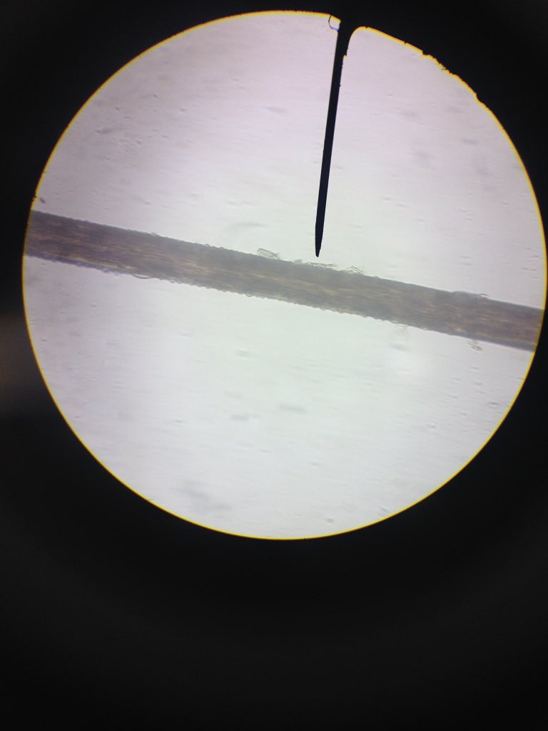 hazelglimocon's tweet photo. Frog's blood and skin hair 🔬 #exercise1 https://t.co/fiL6YDCnZX