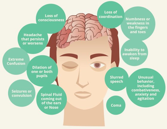 PennMindsMatter's tweet photo. Every 15 seconds someone in the US sustains a Traumatic Brain Injury  https://t.co/oeRSA2i8dw #PennMindsMatter https://t.co/d5txpuNA5B