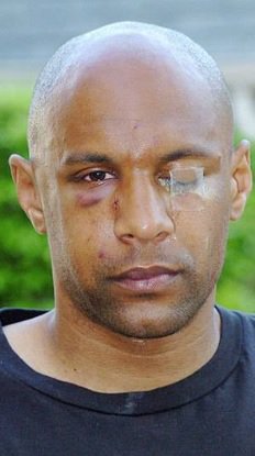 RealSecretRef's tweet photo. @Joey7Barton @neymarjr , think b4 opening your stupid mouth remember doing this to  Ousmane Dabo #THUGBOY https://t.co/KkLXdxFNBg
