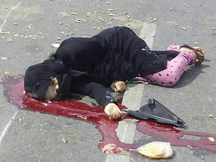 maldhabyani's tweet photo. إمرأة من تعز.. خرجت لشراء رغيف خبز لأطفالها، غير أن قناصاً حوثياً متوحشاً همجيّاً كان لها بالمرصاد..
لك الله يا تعز! https://t.co/2zn2KLq81B