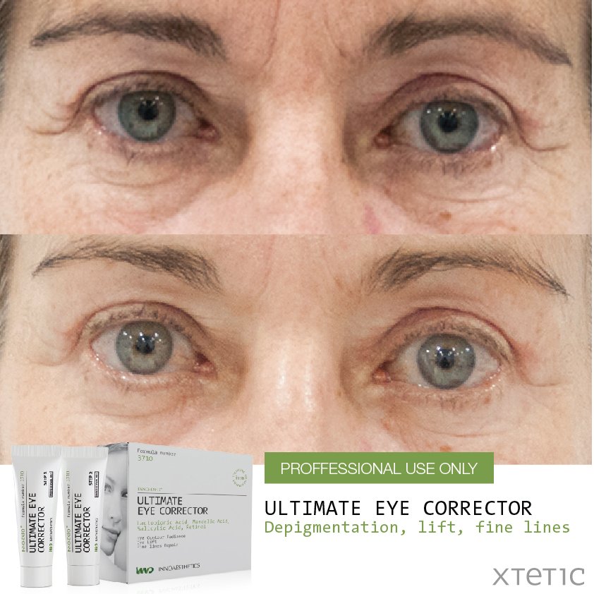 Innoaesthetics's tweet photo. Have you tried the ULTIMATE EYE CORRECTOR?

#skin #care #dark #circles #bags #puffiness #beauty #Amazing #eyes https://t.co/WgM8qXU4Ws