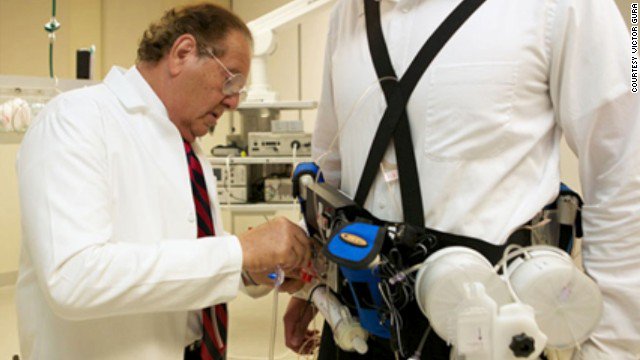CNN's tweet photo. Could wearable 'artificial kidney' free patients of big dialysis machines? https://t.co/w376rtdfIZ https://t.co/1RES1RpupN
