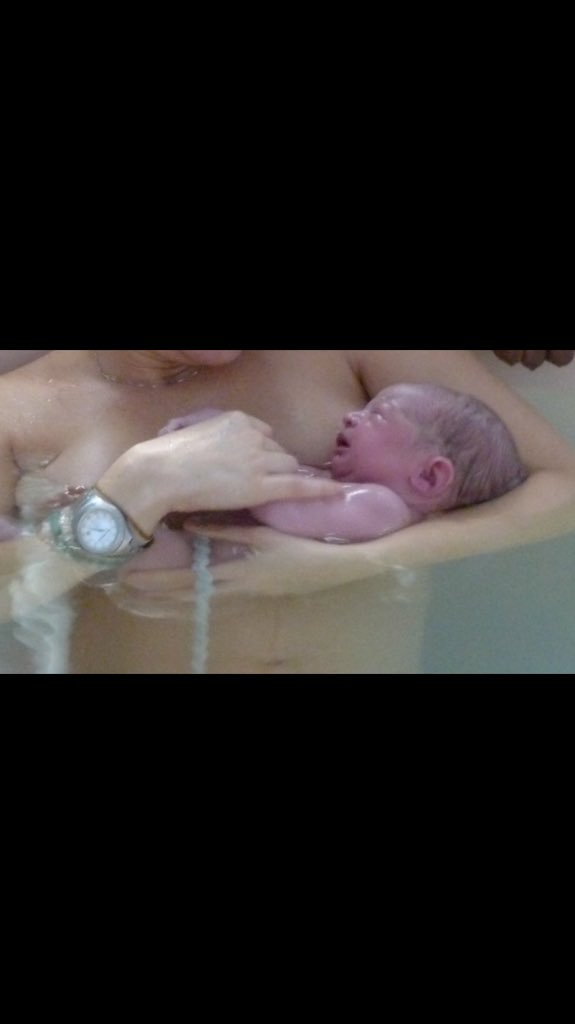 MakeBirthEasier's tweet photo. @optimalclamping @hannahtizard lovely pink baby with white cord #Wait4White #BloodtoBaby https://t.co/XZRBexepbp https://t.co/5uaqFGUGos