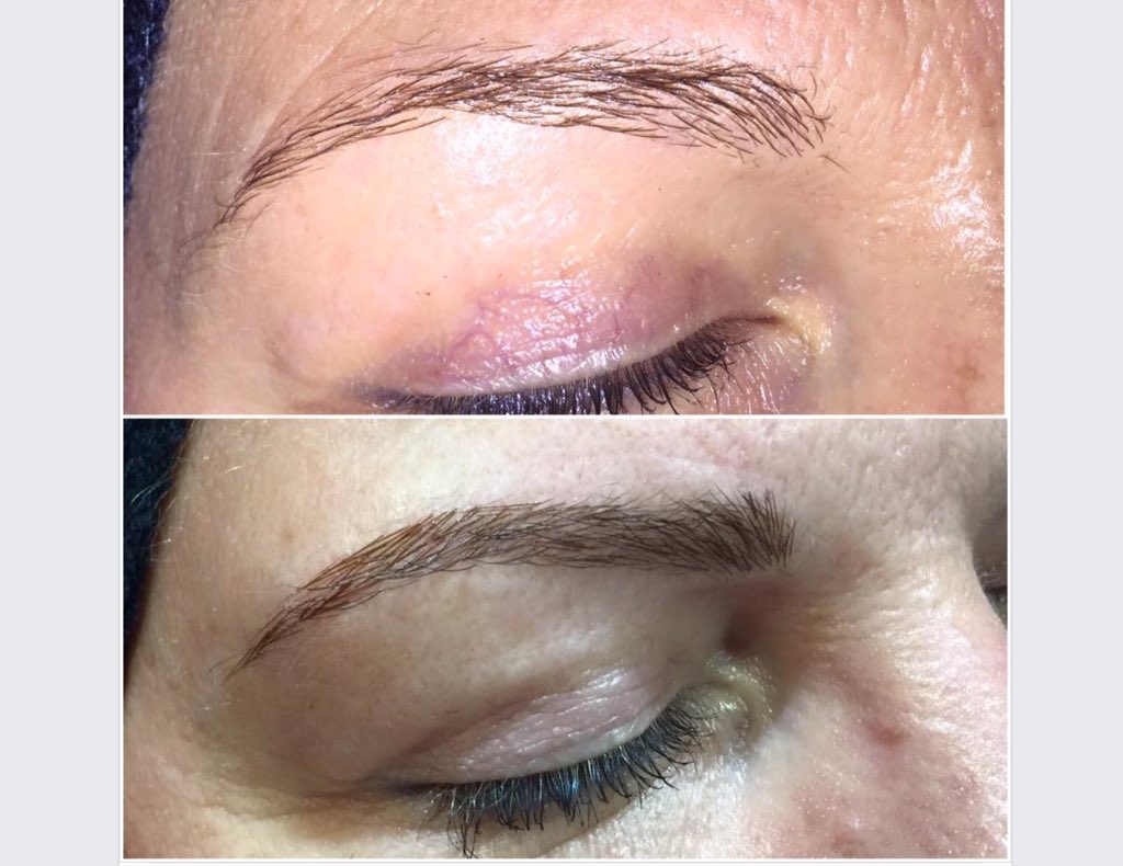 FirstImpressi16's tweet photo. Beautiful 4D Brows @xjodiefosterx #brows #extentions #beauty #firstimpression https://t.co/dWjJ8rwVQD