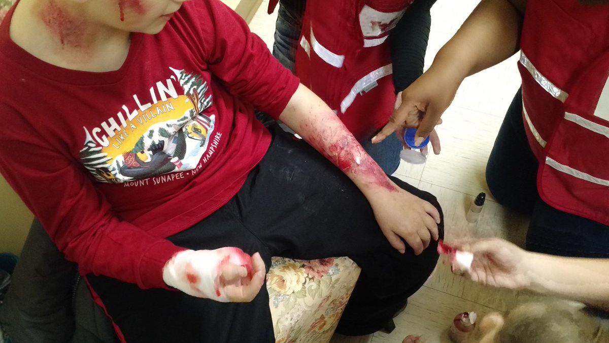 WHS_FireRescue's tweet photo. Injury so real looking a scout fainted and had to be checked out by EMS. #scouttraining https://t.co/OEMObjl6jw