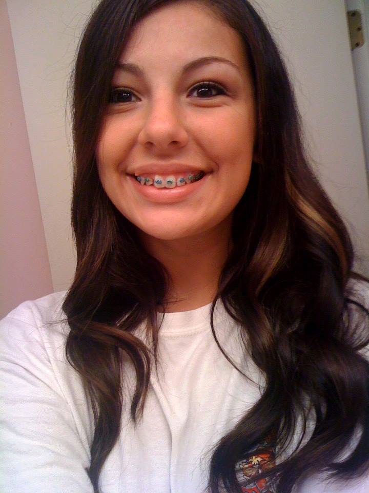 Girls With Braces On Twitter Doesnt Her Colored Braces Look Cute 