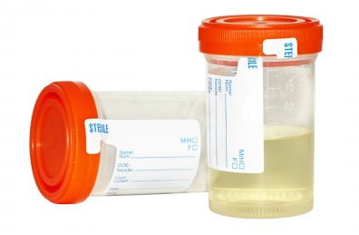 Some of the best ways to pass a Drug Test :)
Keep smoking and piss Clean -> bit.ly/DrugTestss