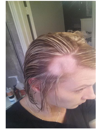 Cristin Severance On Twitter Now Cbsdfw Hundreds Of Women