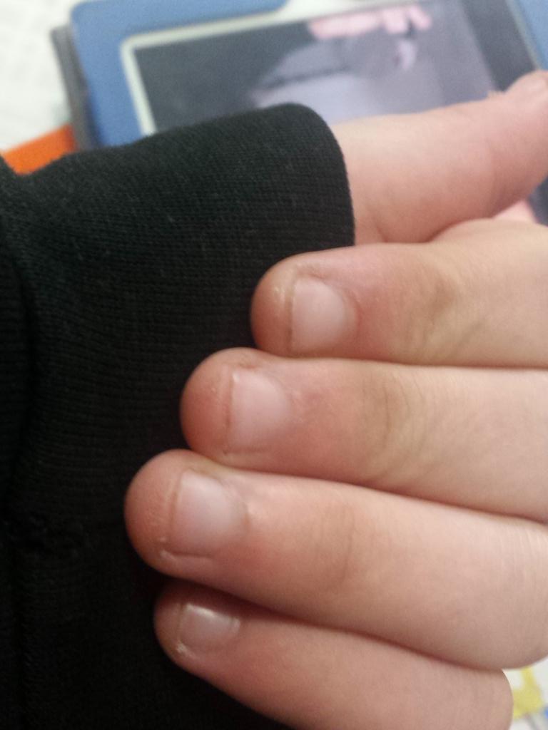 SDKftPhan's tweet image. i bite my nails as well i hate this bad habit @wolfieraps