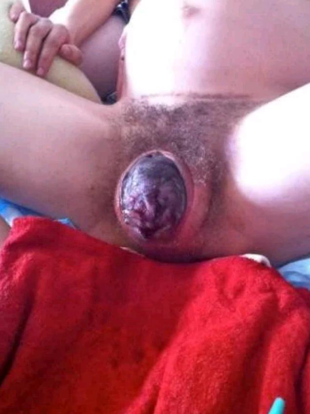 Nude pregnant birth pity Nude pregnant birth possible tell