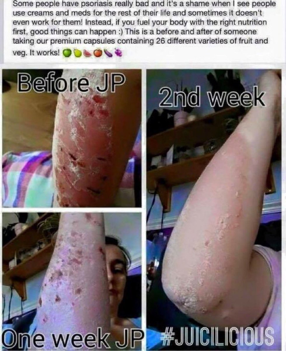 This picture needs no words #juiceplus #premiumcapsules