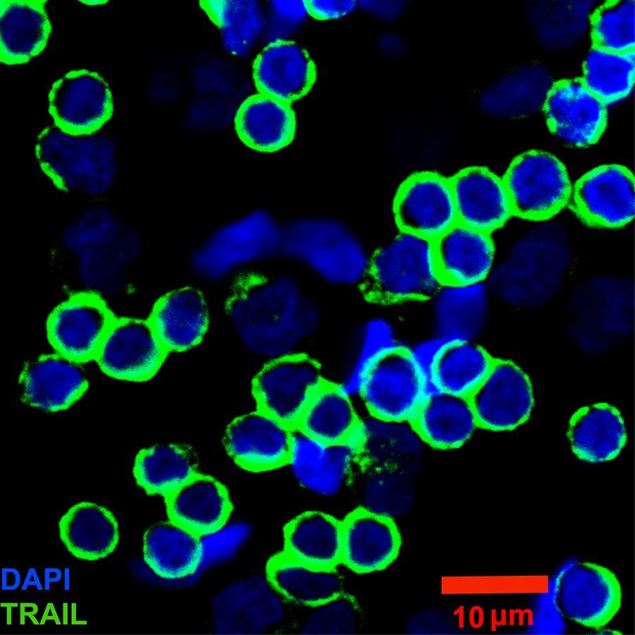 Cornell's tweet photo. #Cornell scientists develop “killer cells” to destroy #cancer in lymph nodes: https://t.co/AQxPVVvX7W https://t.co/CKGESPgTtY