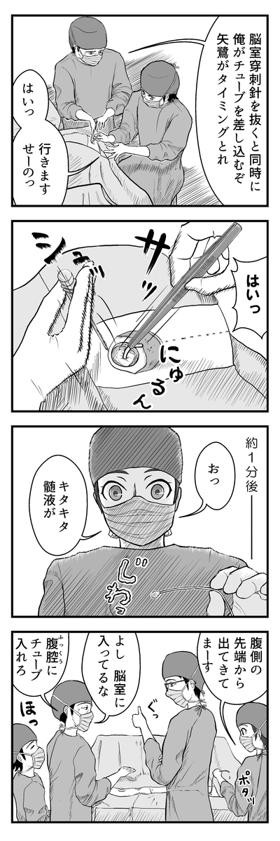 ブログ更新のお知らせ→ のうげかなう。 : 040 みんなでVPシャント術⑭ 脳室チューブ挿入 https://t.co/0yHSDyGPNH 