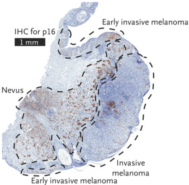 NEJM tweet media