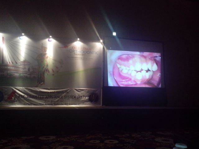 jazzpromomedia's tweet photo. Acara Seminar FKG Unpad (Excellent Ortodontik) 12-14 November 2015 di Trans Hotel, Projector 6500 lumen https://t.co/N8e6I7fQxY