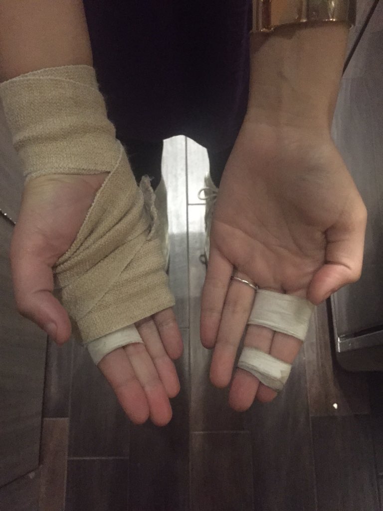 halsey's tweet photo. Def made my hands worse tonight. My Collection of broken knuckles is increasing im using the talk to text function https://t.co/DcOHPYoBEw