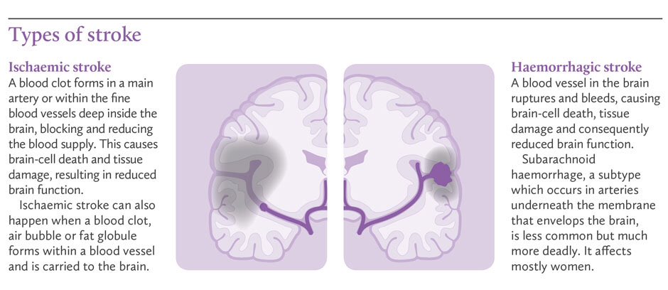 ischemic stroke vs hemorrhagic stroke