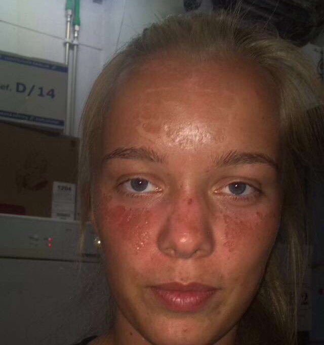 Langaði bara að minna fólk á að nota sólarvörnina